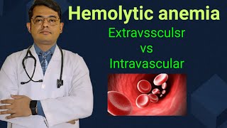 Hemolytic anemia Extravsscular vs Intravascular  Simplified explanation [upl. by Slorac]