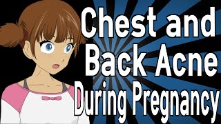 Chest and Back Acne During Pregnancy [upl. by Ladnek880]