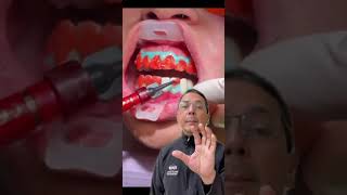 FAST Teeth Whitening In Office Procedure with Opalenscence  View Mobile Dental [upl. by Nysilla]