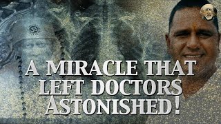 A Miracle That Left Doctors Astonished [upl. by Aisital]