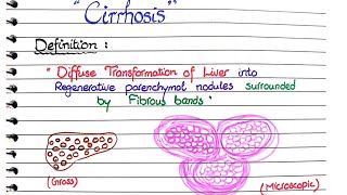 Cirrhosis of Liver  Pathology [upl. by Jain962]