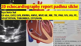 2D echocardiography ki report padhna sikhe [upl. by Gesner267]