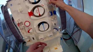 How to setup dialysis fresenius 5008 machine Frenchdialyse [upl. by Prent]