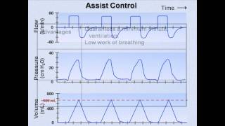 Ventilator Modes Mechanical Ventilation  Lecture 7 [upl. by Yborian]