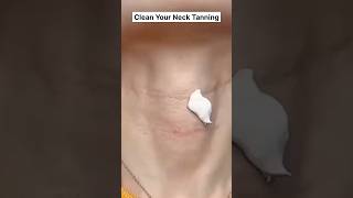 Dark Neck Home Remedies  Neck Whitening TipsGet Rid of Dark Neck skincare ytshorts viral short [upl. by Byrdie]