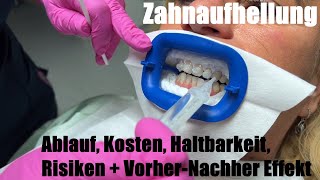 Power Bleaching Zahnaufhellung  Ablauf Kosten Haltbarkeit Risiken  VorherNachher ZKU Effekt [upl. by Ipoillak]