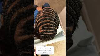 Would U rather 2024 alopecia haircare crochet hairstyle hair shedidthat milliondollarbaby [upl. by Anoirb]