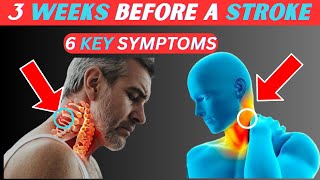 6 Top Stroke Symptoms 3 Weeks before it happens [upl. by Helban2]