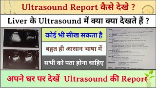 Ultrasound Report kaise dekhe  Liver ke Ultrasound me kya kya dekhte hai  liver ultrasound report [upl. by Ecenahs907]