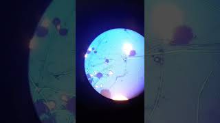 Rhizopus under microscope microbiology science [upl. by Atirahc]