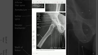 Hip Xray ☢️xraytechnician xray xraytechtrending virahipxray [upl. by Adelpho]