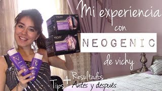 Neogenic de Vichy Mi experiencia tips antes y después Kriss [upl. by Marco691]