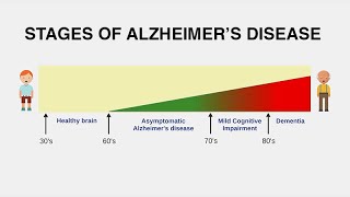 Diagnosing Alzheimer’s Disease [upl. by Auahsoj]