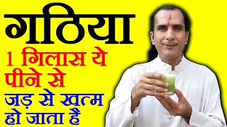 गठिया का इलाज  Gathiya ka ilaj  Jodo ke dard Ka ilaj  Arthritis Treatment in Hindi [upl. by Frank]