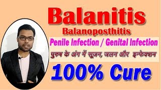 Balanitis  How to Cure Balanitis  पुरुष के अंग में सूजन जलन और इन्फेक्शन का इलाज [upl. by Drue935]