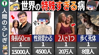 【衝撃】実在する世界の特殊すぎる奇病5選【ゆっくり解説】 [upl. by Yennep]