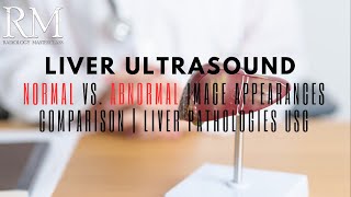 Liver Ultrasound Normal vs Abnormal Image Appearances Comparison  Liver Pathologies USG [upl. by Hylton]