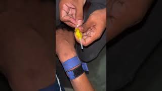 How to insert iv cannula iv cannula kaise lagate hain iv cannula insertion iv Cannulation shorts [upl. by Netsyrk]