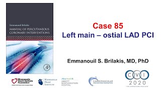 Case 85 PCI Manual  Ostial left mainLAD bifurcation stenting [upl. by Kciwdahc]