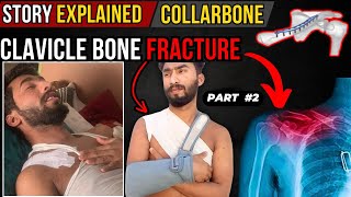 clavicle fracture natural healing  collarbone fracture  clavicle collarbone [upl. by Donelle]