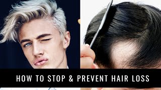 HOW TO STOP amp PREVENT HAIR LOSS  Keeps Review [upl. by Calandria]