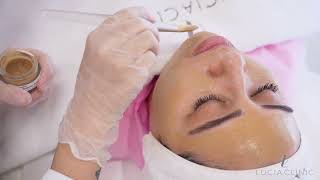 Experience flawless skin with Dermamelan at Lucia Clinic [upl. by Sparkie]