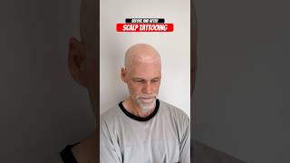 scalpmicro scalpmicropigmentation hairlosstreatment smptraining [upl. by Saville]