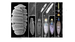 Dinoflagellates  Nematocysts [upl. by Zelma903]