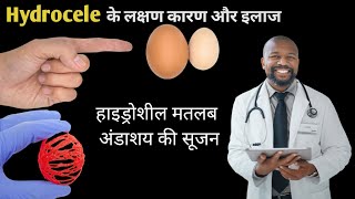 hydrocele symptoms and treatment हाइड्रोशील के लक्षण कारण और इलाज क्या हैं hydrocele [upl. by Fabron]