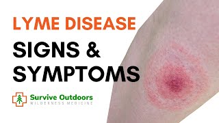 What are the Symptoms of Lyme Disease [upl. by Eneles]