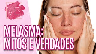 Mitos e verdades sobre MELASMA  Você Bonita 091220 [upl. by Delaney273]