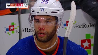 Darnell Nurse Struck By A Puck In The Face After Puck Bounced Off The Crossbar And Hit Him [upl. by Cahn367]