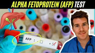 Doctor explains Alpha Fetoprotein AFP blood test  Liver and testicular cancer [upl. by Bowman]