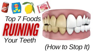 Top 7 Foods Secretly Destroying Your Teeth amp  How to Stop It [upl. by Syverson]