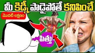 Kidney Disease Symptoms In Telugu  Dr VamshiPriya  iD Health 360 [upl. by Teagan113]