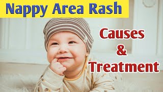 Nappy Area Rash Causes Symptoms Diagnosis amp Treatment [upl. by Karub]