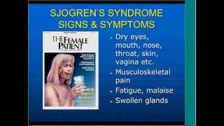 Sjogrens Syndrome Beyond Dry Eyes and Mouth by Frederick Vivino MD [upl. by Ardnohsal787]