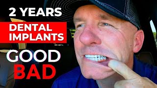 The GOOD and BAD Of My Dental Implants After 2 Years [upl. by Bernardine]