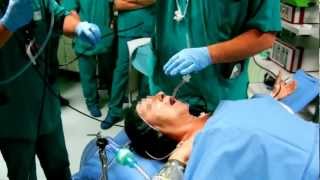 Awake Fiberoptic Intubation [upl. by Crow70]