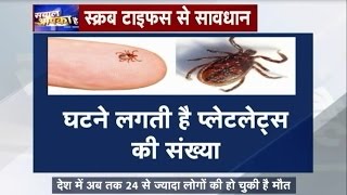 Scrub Typhus a new disease in Bhopal  Sawal Aap Ka Hai [upl. by Lokim]