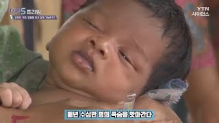 불치병 난치병을 치료하는 미래의학 유전자 가위기술 DNA는 인간의 영역인가 신의 영역인가 불치병 난치병 치료 미래의학 유전자치료 유전자 무병장수 코로나 [upl. by Ahsiekat960]