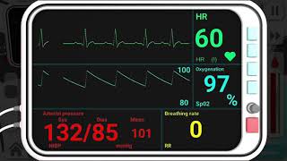 Reanimation inc  Angina pectoris [upl. by Yssak]