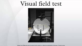 Visual field test [upl. by Herby]