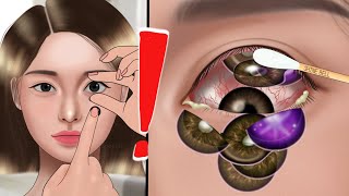 ASMR Removal of many contact lenses from the eye👁 Animation oshi no ko [upl. by Mommy]