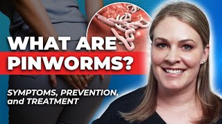 How To Treat Pinworms Symptoms Transmission Treatment amp Prevention [upl. by Yelruc]