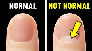 Your Nails Reveal How Rare and Unique Your Body Truly Is [upl. by Aneekal]