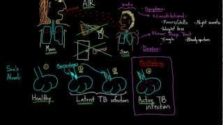 Symptoms and Spread of Tuberculosis [upl. by Auohs690]