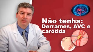 Dr Alexandre Amato Revela os Segredos da Prevenção de Derrames [upl. by Davin]