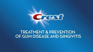 Treatment amp Prevention of Gum Disease and Gingivitis  Crest [upl. by Nareik]