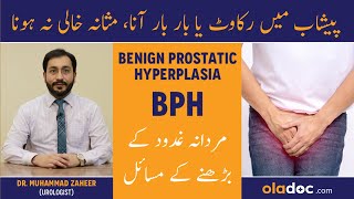 Benign Prostatic Hyperplasia BPH Treatment  Mardana Ghadood Barh Jana  Pesshab Ke Masail Ka Ilaj [upl. by Rentsch]